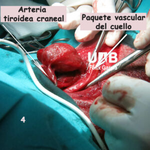Liberaremos la masa de los tejidos circundantes, a ella llegarán la Arteria tiroidea craneal y la caudal